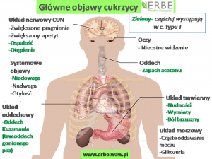 Cukrzyca choroba naszych czasów - typy i objawy, erbe.waw.pl